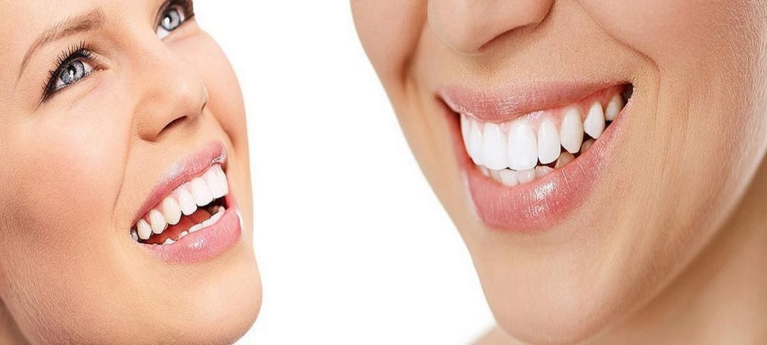 Jak chronić zęby przed osadami i przebarwieniami? 
