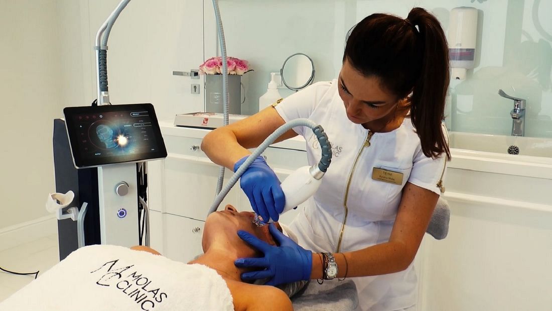 Terapie łączone w zabiegach na twarz - radiofrekwencja mikroigłowa Secret RF i peeling laserowy Fraxis Molas Clinic